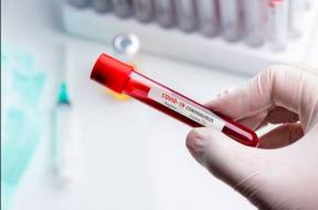 TESTE GRATUITE DE COVID – Romanii se vor testa gratuit pentru depistarea coronavirusului in orice unitate sanitara, spital sau laborator autorizat. Casa Nationala de Sanatate va deconta costul